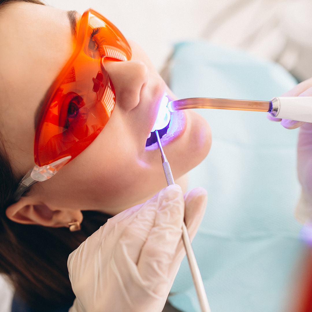 tratamiento para gingivitis en adultos limpieza dentista